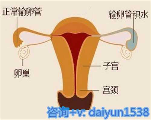 上海辅助生殖费用深度解析：供卵与常规第三代试管婴儿的费用差异